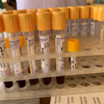 Blood Samples